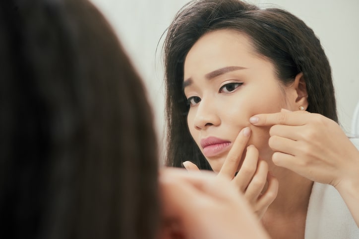 Woman pinching her cheek