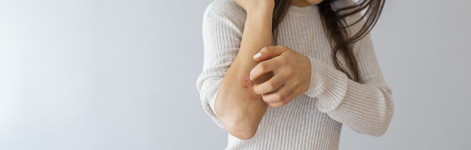 Woman scratching arm on grey background