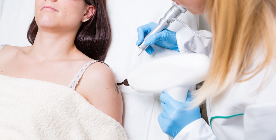 tattooremoval crop
