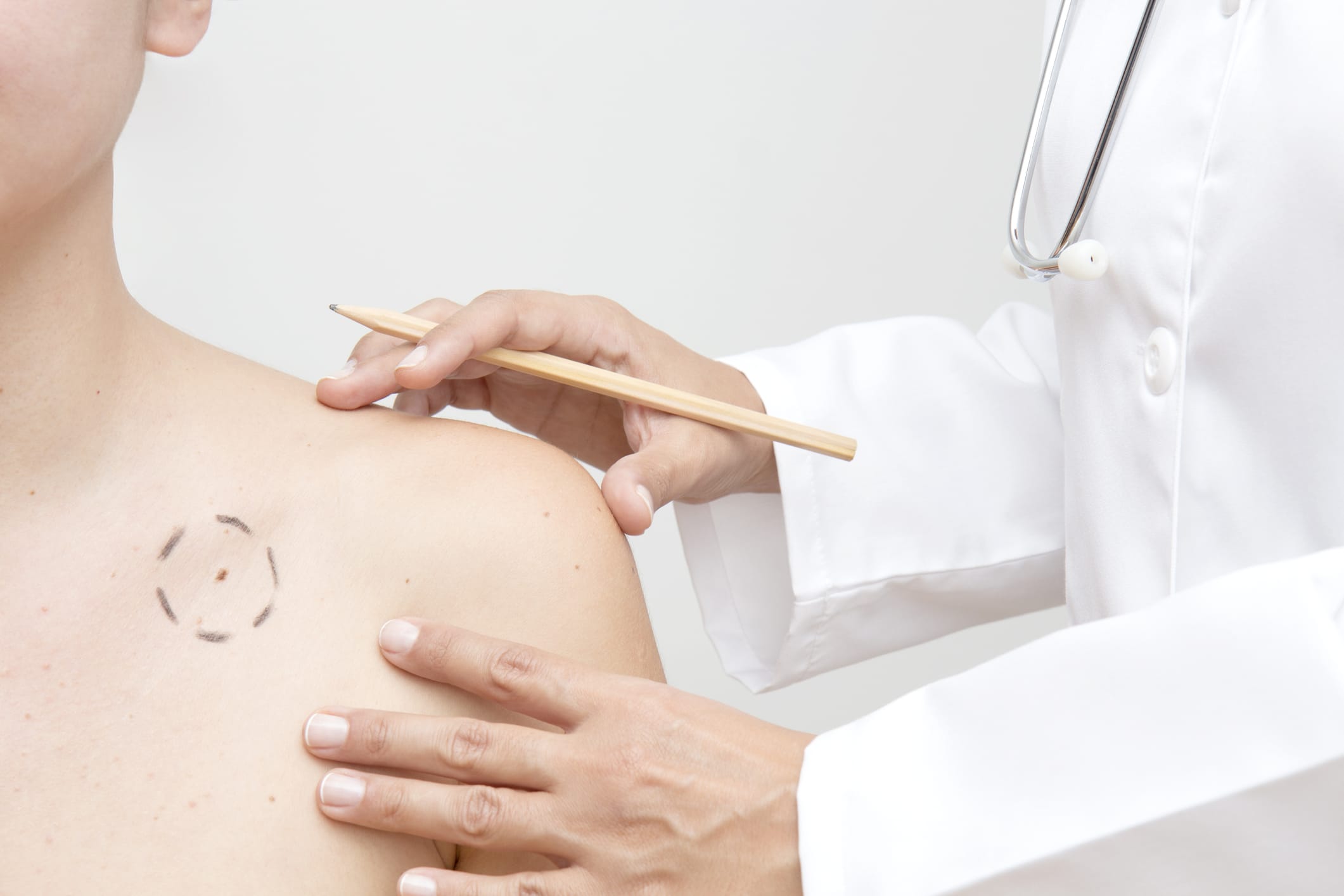 Mohs Surgery Dade City FL