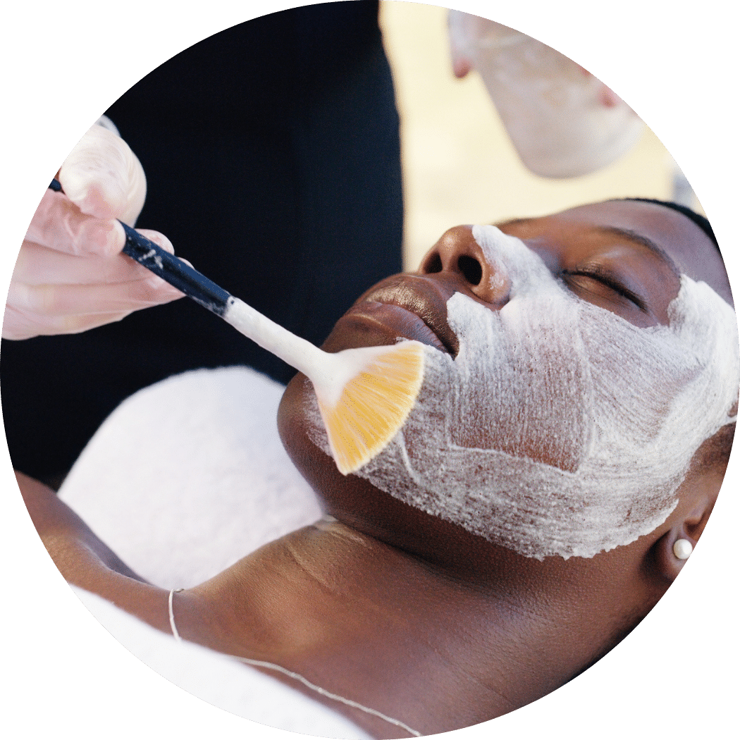 Chemical Peel